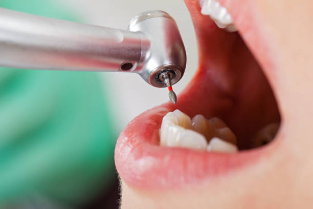 Best Mobile Emergency Dentist in Bonneau Beach, SC